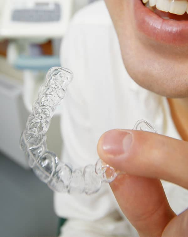 City Dental Center Services General Dentistry Mouth Guard