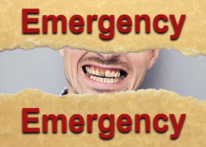 Find Emergency Dentists Near Me Open Now!