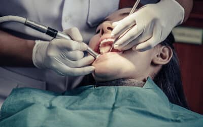 Do I Need a Root Canal or Root Canal Therapy?