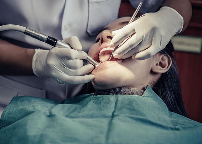 Do I Need a Root Canal or Root Canal Therapy?