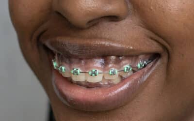 What Is Orthodontics & What Can It Do For Me?